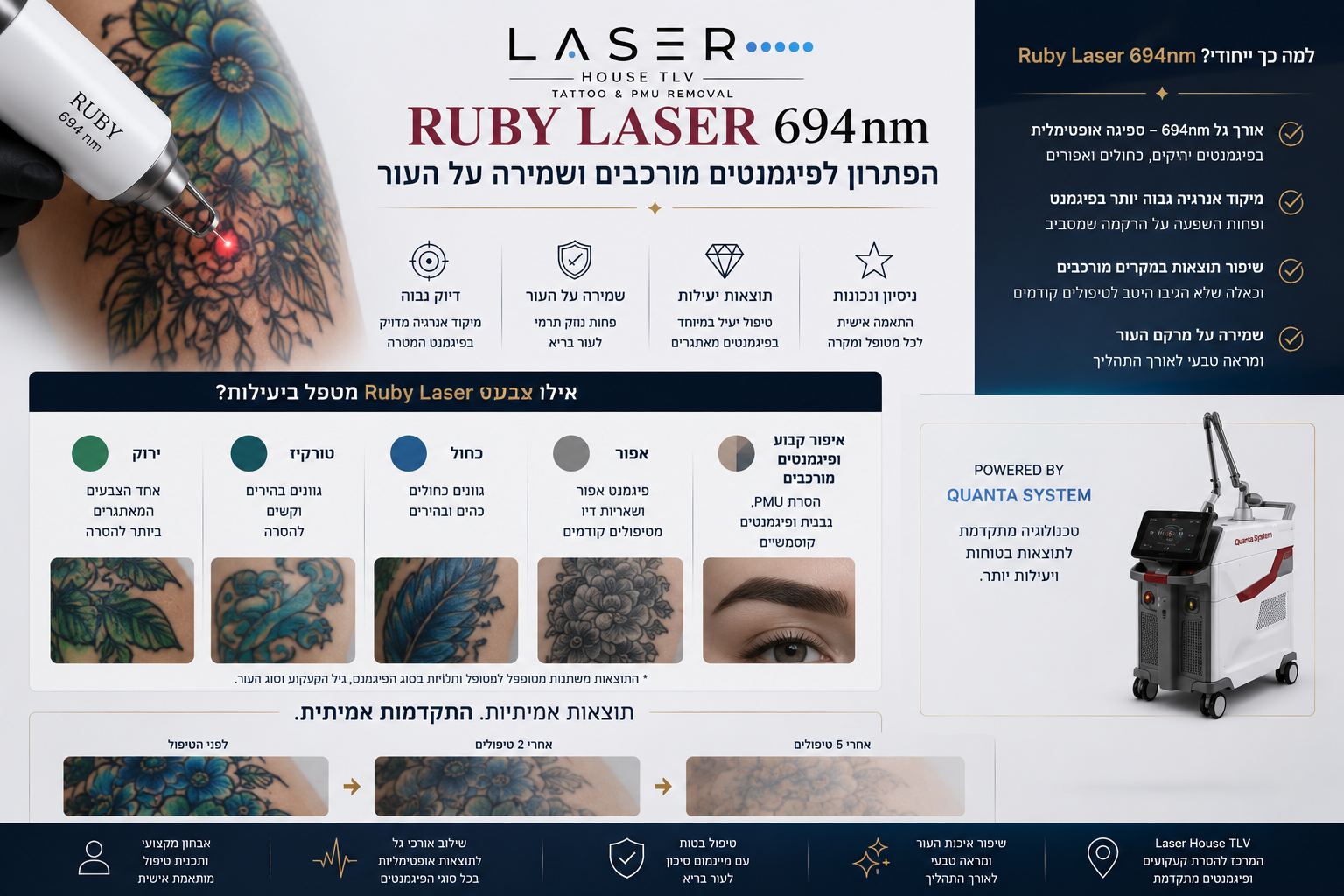 רובי לייזר