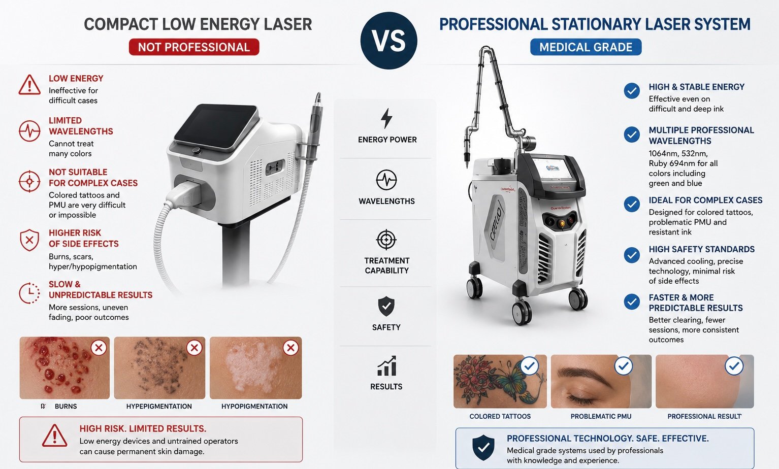 professional laser tattoo removal