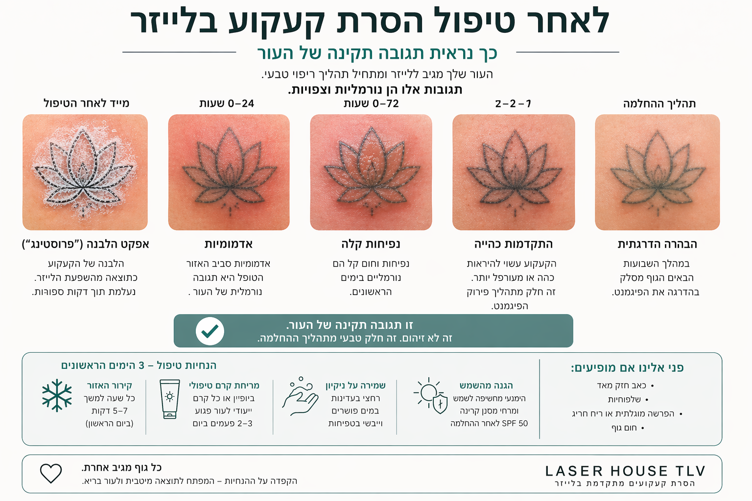 tattoo removal
