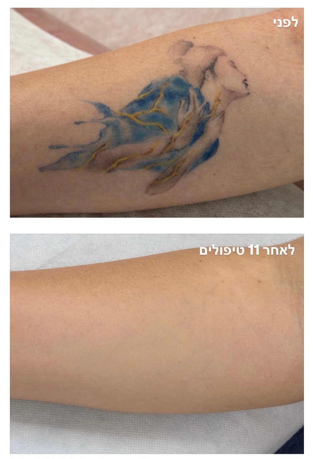 color tattoo before&after