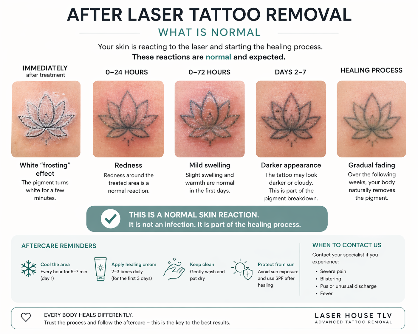 how-look-like-tatto-after-removal-session