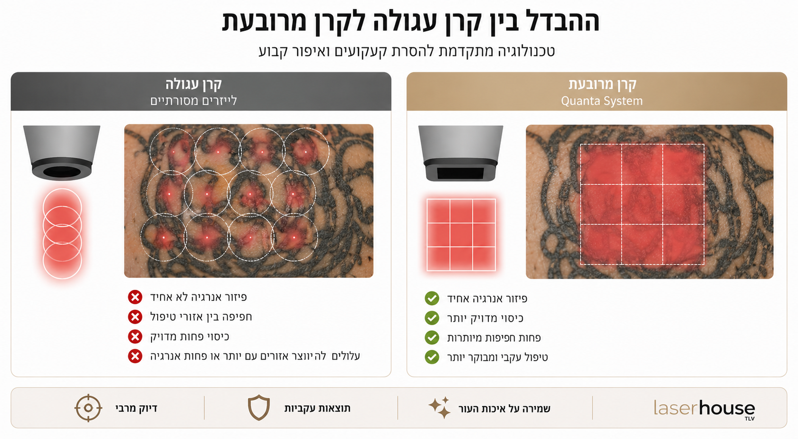 לייזר הסרת קעקועים