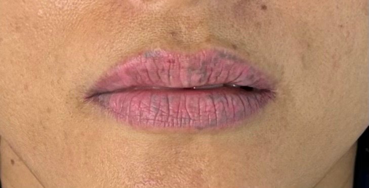 pmu lips