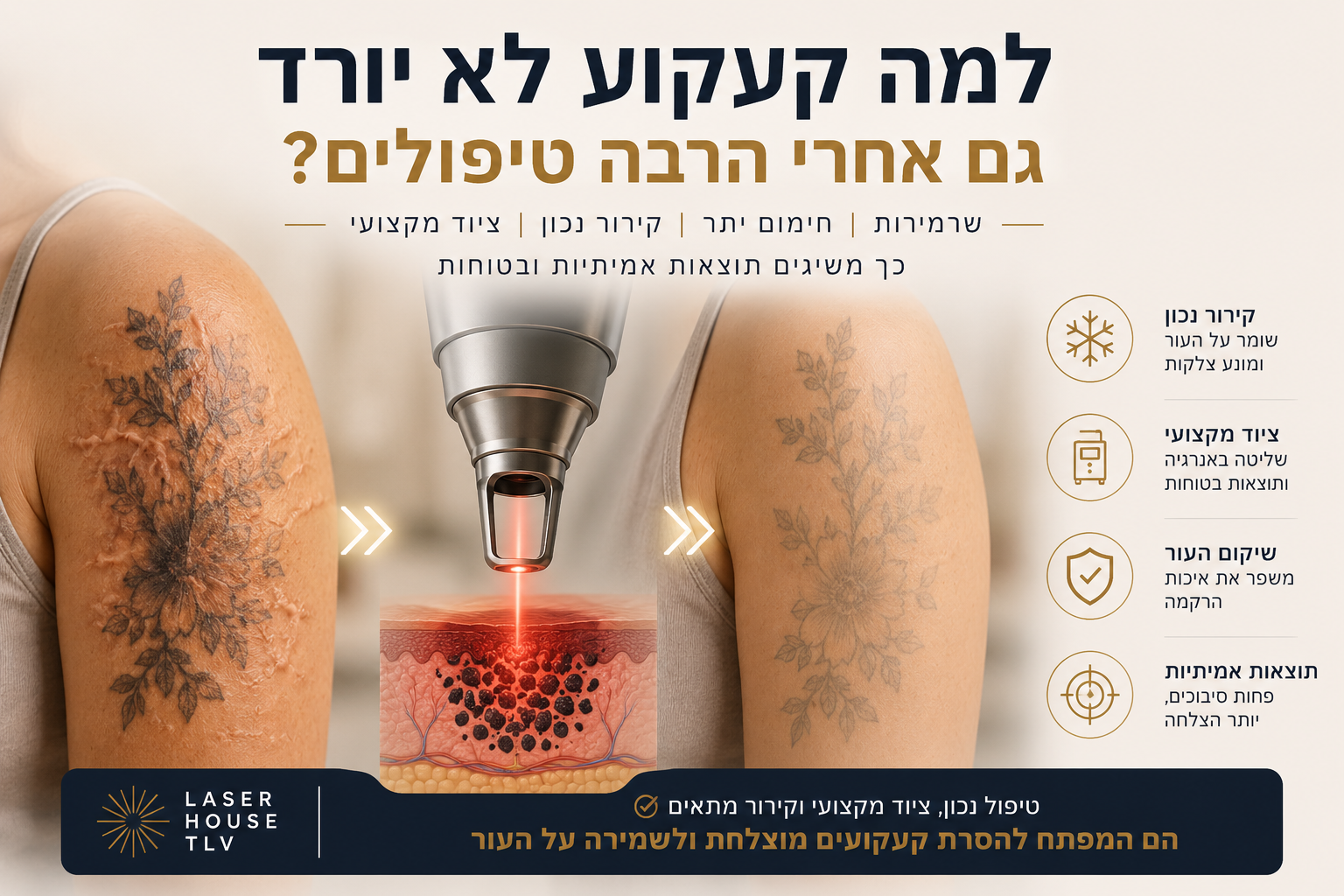 למה קעקוע לא יורד גם אחרי הרבה טיפולים?