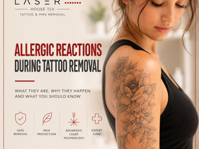 Allergic Reactions During Tattoo Removal: Why Its Happen and What You Should Know