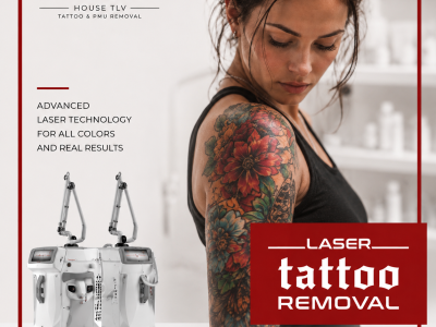 Advanced Colored Tattoo Removal And Pigment-Specific Laser Technology