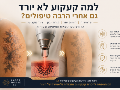 למה קעקוע לא יורד גם אחרי הרבה טיפולים?