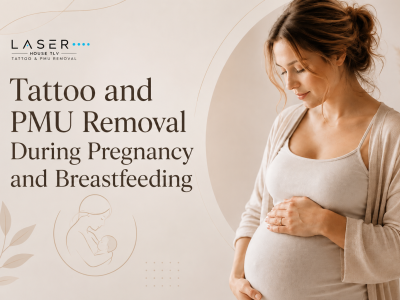 Tattoo and PMU Removal During Pregnancy and Breastfeeding: Is It Safe?